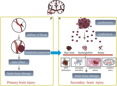 Mesenchymal Stem Cell Application and Its Therapeutic Mechanisms in Intracerebral Hemorrhage